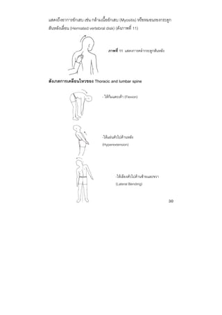 30 
 
แสดงถึงอาการอักเสบ เชน กลามเนื้ออักเสบ (Myositis) หรือหมอนรองกระดูก
สันหลังเลื่อน (Herniated vertebral disk) (ดังภาพที่ 11)
สังเกตการเคลื่อนไหวของ Thoracic and lumbar spine
- ใหกมแตะเทา (Flexion)
-ใหแอนตัวไปดานหลัง
(Hyperextension)
-ใหเอียงตัวไปดานซายและขวา
(Lateral Bending)
ภาพที่ 11 แสดงการคลํากระดูกสันหลัง
 