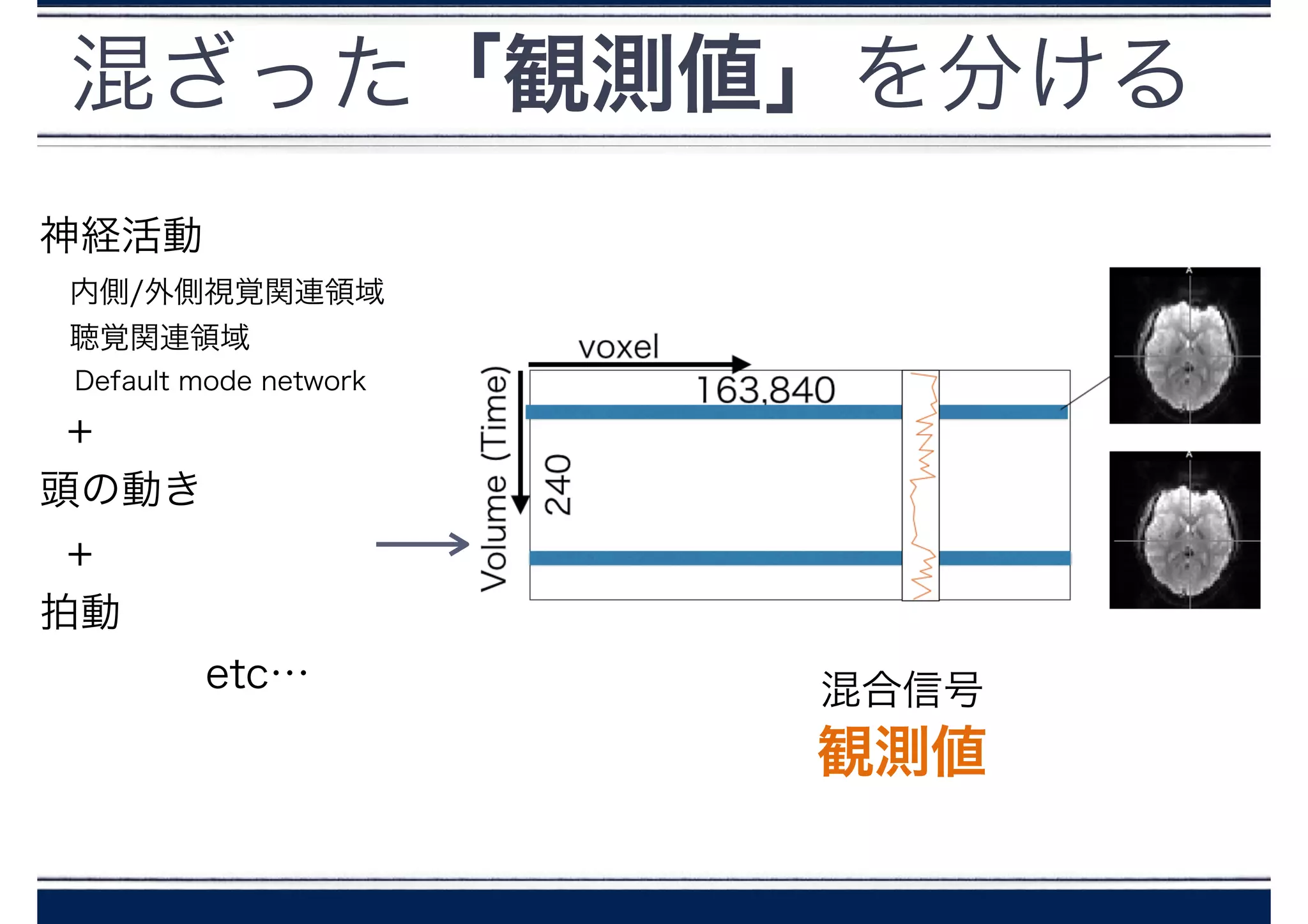 混ざった「観測値」を分ける
混合信号
神経活動
 内側/外側視覚関連領域
 聴覚関連領域
  Default mode network
+
頭の動き
+
拍動
etc…
観測値
 