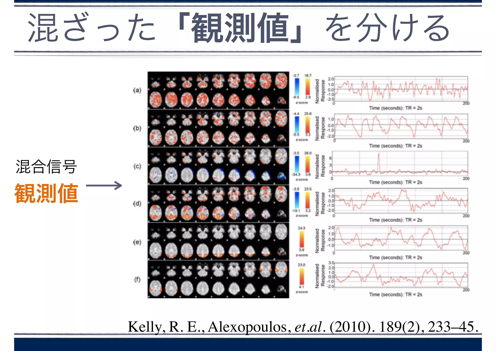 混合信号
観測値
混ざった「観測値」を分ける
Kelly, R. E., Alexopoulos, et.al. (2010). 189(2), 233–45.
 