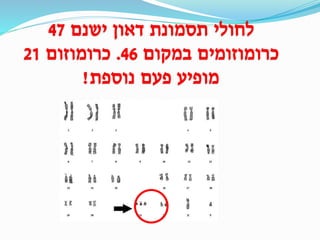 ‫ישנם‬ ‫דאון‬ ‫תסמונת‬ ‫לחולי‬47
‫במקום‬ ‫כרומוזומים‬46.‫כרומוזום‬21
‫נוספת‬ ‫פעם‬ ‫מופיע‬!
 