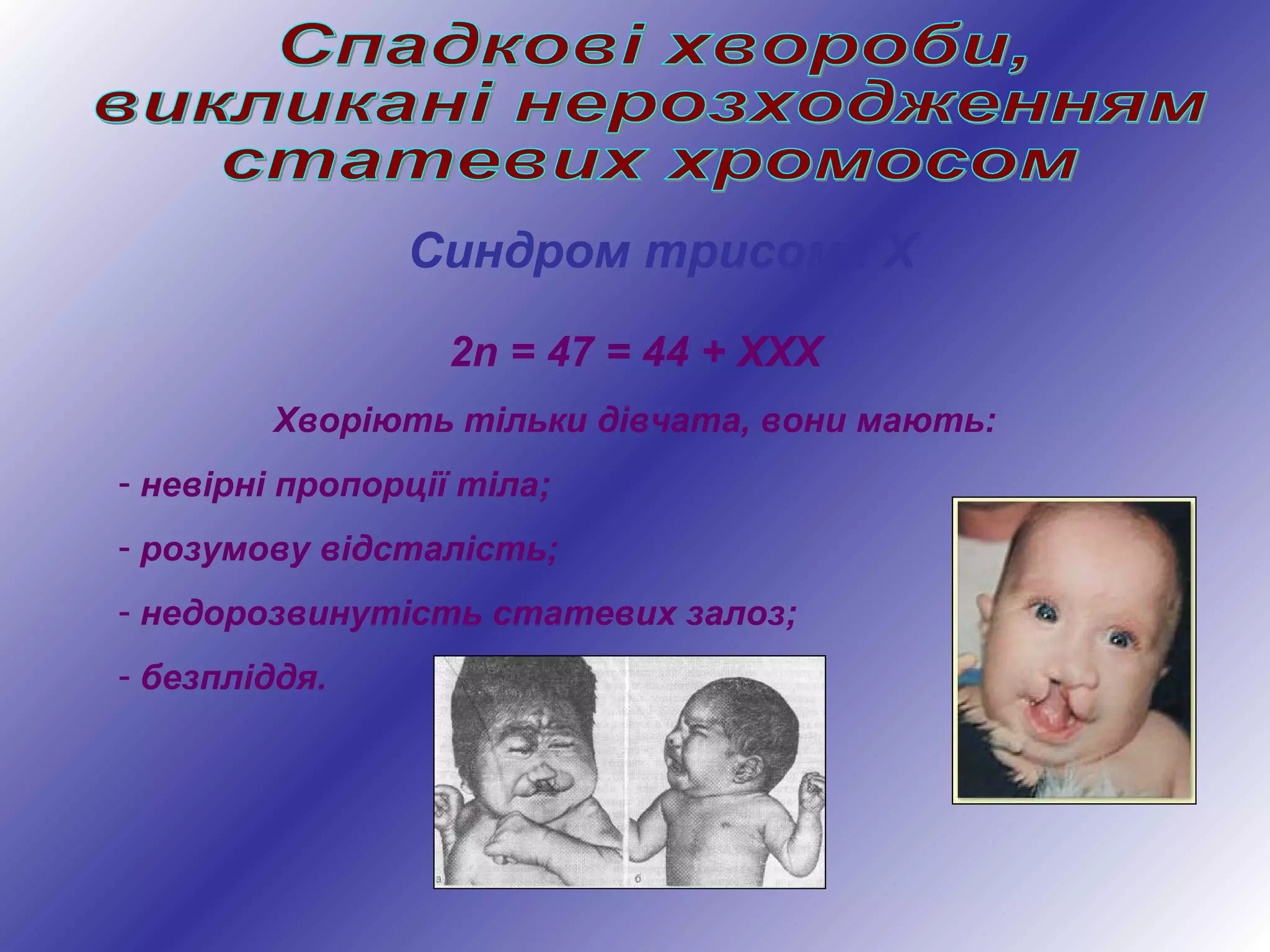 Синдром трисомії Х
2n = 47 = 44 + ХХХ
Хворіють тільки дівчата, вони мають:
- невірні пропорції тіла;
- розумову відсталість;
- недорозвинутість статевих залоз;
- безпліддя.
 