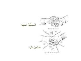 ‫المٌته‬ ‫السمكة‬
‫الٌد‬ ‫طاحن‬
 