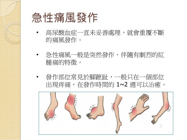 痛風民眾衛教