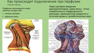 Как происходит подключение при перфузии
(общий подход)
Перфузия производится через
крупные сосуды шеи:
• -сонные артерии
• -ярёмные вены
Через артерии введение
криопротекторов, через вены - отток
отработанного перфузионного
раствора, промывочной жидкости и
остатков крови и тромботических масс
 