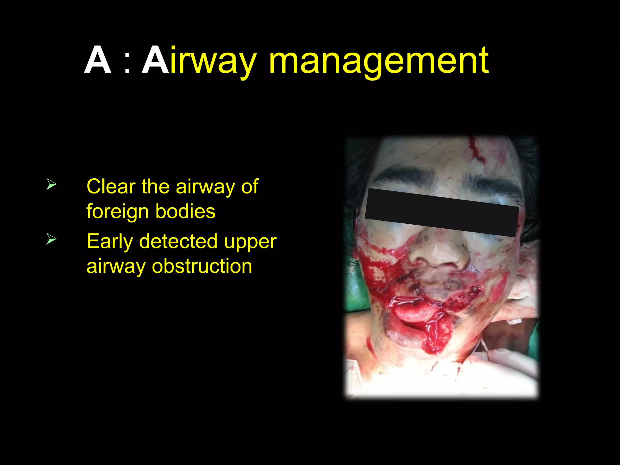 AA :: AAirwayirway managementmanagement
 Clear the airway ofClear the airway of
foreign bodiesforeign bodies
 Early detected upperEarly detected upper
airway obstructionairway obstruction
 