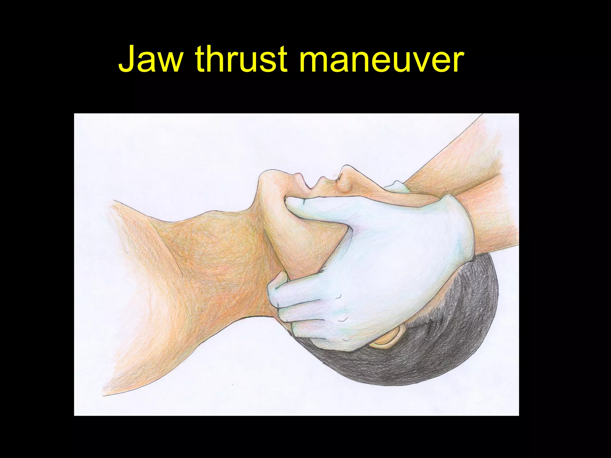 Jaw thrust maneuverJaw thrust maneuver
 