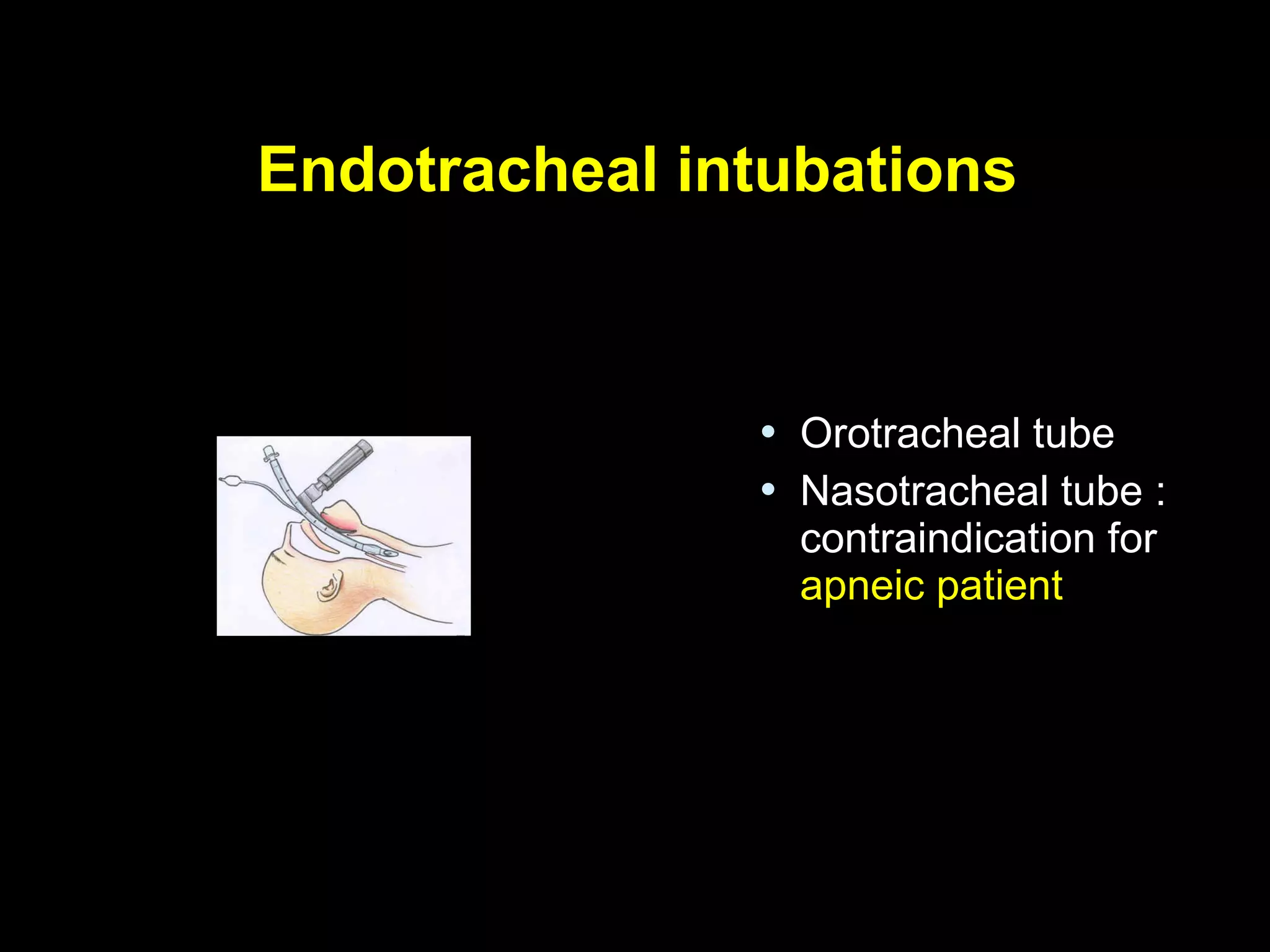 Endotracheal intubationsEndotracheal intubations
 Orotracheal tubeOrotracheal tube
 Nasotracheal tube :Nasotracheal tube :
contraindication forcontraindication for
apneic patientapneic patient
 