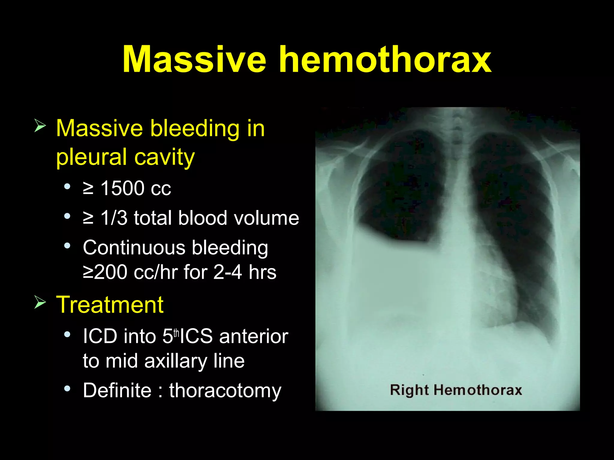 Massive hemothoraxMassive hemothorax
 Massive bleeding inMassive bleeding in
pleural cavitypleural cavity

≥≥ 1500 cc1500 cc

≥≥ 1/3 total blood volume1/3 total blood volume

Continuous bleedingContinuous bleeding
≥200 cc/hr for 2-4 hrs≥200 cc/hr for 2-4 hrs
 TreatmentTreatment

ICD into 5ICD into 5thth
ICS anteriorICS anterior
to mid axillary lineto mid axillary line

Definite : thoracotomyDefinite : thoracotomy
 