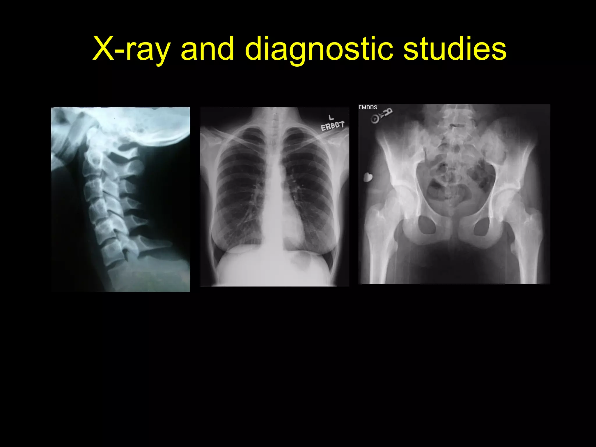 X-ray and diagnostic studiesX-ray and diagnostic studies
 