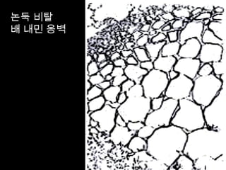 논둑 비탈
배 내민 옹벽
 