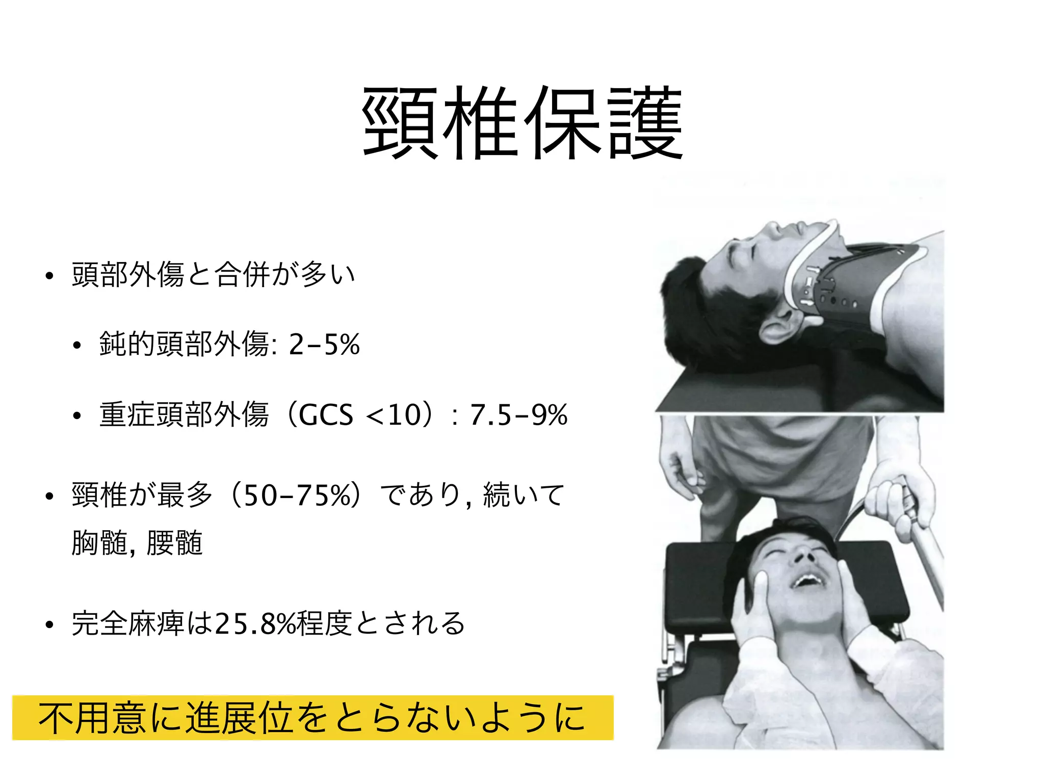 頸椎保護
• 頭部外傷と合併が多い
• 鈍的頭部外傷: 2-5%
• 重症頭部外傷（GCS <10）: 7.5-9%
• 頸椎が最多（50-75%）であり, 続いて
胸髄, 腰髄
• 完全麻痺は25.8%程度とされる
不用意に進展位をとらないように
 