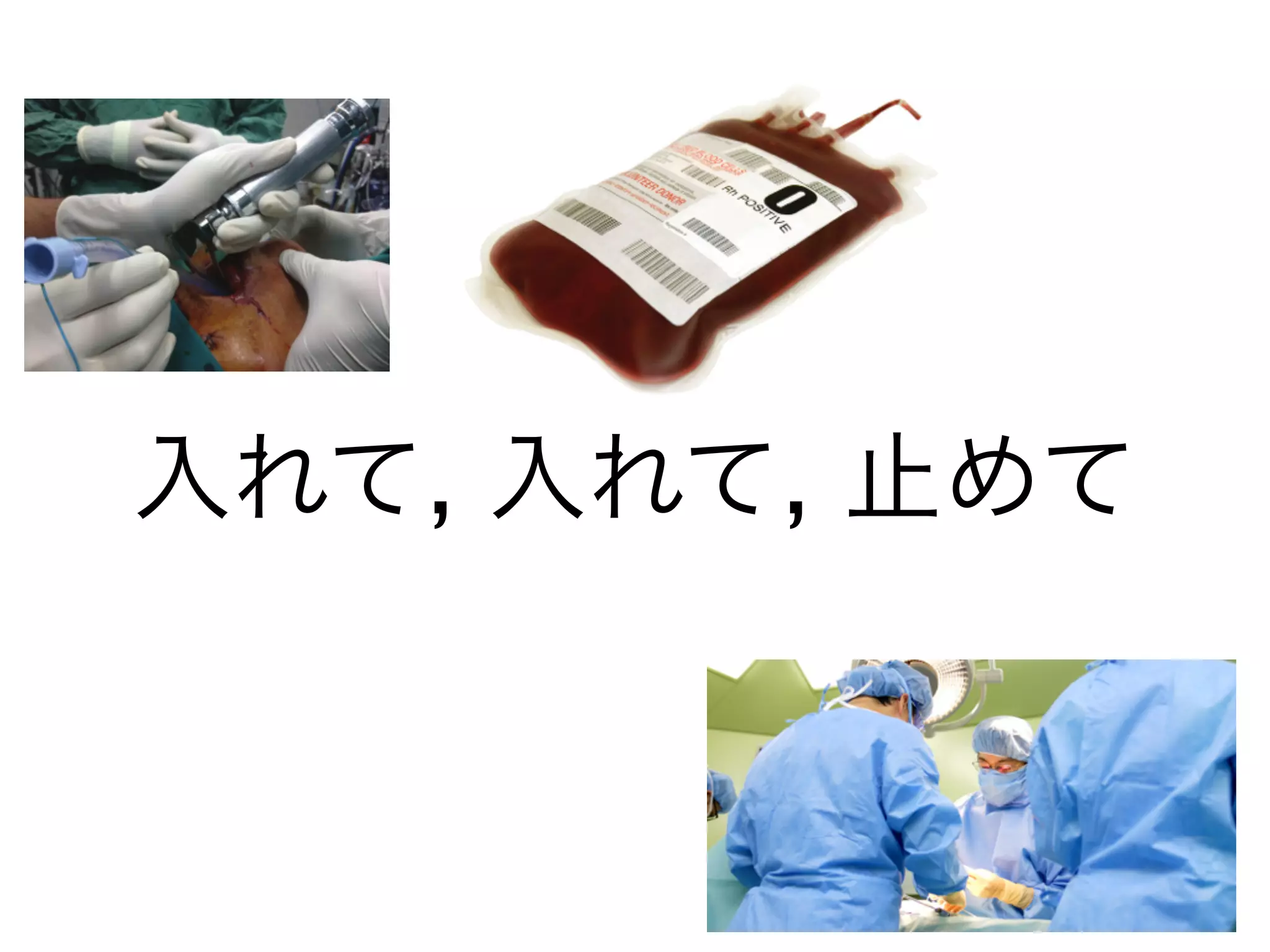 入れて, 入れて, 止めて
 