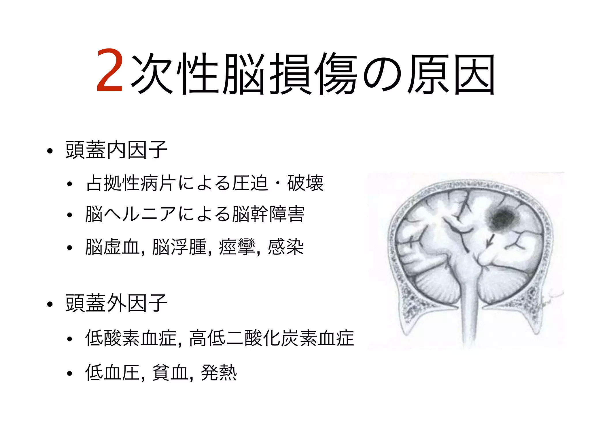 2次性脳損傷の原因
• 頭蓋内因子
• 占拠性病片による圧迫・破壊
• 脳ヘルニアによる脳幹障害
• 脳虚血, 脳浮腫, 痙攣, 感染
!
• 頭蓋外因子
• 低酸素血症, 高低二酸化炭素血症
• 低血圧, 貧血, 発熱
 
