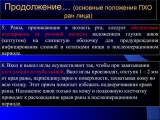 Продолжение…Продолжение… (основные положения ПХО(основные положения ПХО
ран лица)ран лица)
5. Раны, проникающие в полость рта, следует обязательно
изолировать от ротовой полости наложением глухих швов
(кетгутом) на слизистую оболочку для предупреждения
инфицирования слюной и остатками пищи в послеоперационном
периоде.
6. Вкол и выкол иглы осуществляют так, чтобы при завязывании
узел уходил в глубь тканей. Вкол иглы производят, отступя 1 – 2 мм
от края раны, перпендикулярно к поверхности, захватывая кожу во
всю толщу. Этот прием помогает избежать подворачивания краев
раны. Наложение швов только на кожу и подкожную клетчатку
приводит к расхождению краев раны в послеоперационном
периоде.
 