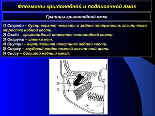 Флегмоны крылонебной и подвисочной ямокФлегмоны крылонебной и подвисочной ямок
Границы крылонебной ямки
1) Спереди – бугор верхней челюсти и задняя поверхность глазничного
отростка небной кости.
2) Сзади – крыловидный отросток клиновидной кости.
3) Снаружи – стенки нет.
4) Снутри – вертикальная пластинка небной кости.
5) Сверху – глубокий отдел нижней глазничной щели.
6) Снизу – большой небный канал.
 