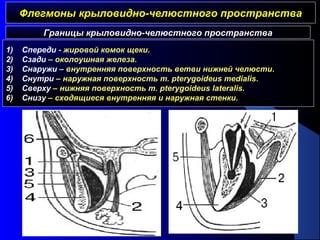 Флегмоны крыловидно-челюстного пространстваФлегмоны крыловидно-челюстного пространства
Границы крыловидно-челюстного пространства
1) Спереди - жировой комок щеки.
2) Сзади – околоушная железа.
3) Снаружи – внутренняя поверхность ветви нижней челюсти.
4) Снутри – наружная поверхность m. pterygoideus medialis.
5) Сверху – нижняя поверхность m. pterygoideus lateralis.
6) Снизу – сходящиеся внутренняя и наружная стенки.
 