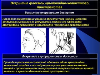 Вскрытие флегмон крыловидно-челюстногоВскрытие флегмон крыловидно-челюстного
пространствапространства
Проводят окаймляющий разрез в области угла нижней челюсти,
отделяют сухожилие m. pterygoideus medialis от tuberossitas
pterygoidea и проникают в крыловидно–челюстное пространство
Вскрытие внеротовым доступом
Вскрытие внутриротовым доступом
Проводят рассечение слизистой оболочки вдоль крыловидно-
челюстной складки, с последующим тупым расслоением мягких
тканей и проникновением по внутренней поверхности ветви нижней
челюсти в крыловидно-челюстное пространство.
 