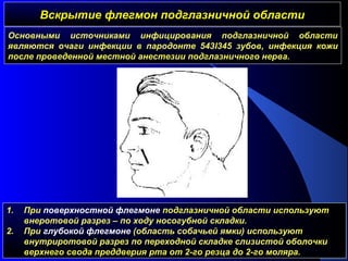 Вскрытие флегмон подглазничной областиВскрытие флегмон подглазничной области
1. При поверхностной флегмоне подглазничной области используют
внеротовой разрез – по ходу носогубной складки.
2. При глубокой флегмоне (область собачьей ямки) используют
внутриротовой разрез по переходной складке слизистой оболочки
верхнего свода преддверия рта от 2-го резца до 2-го моляра.
Основными источниками инфицирования подглазничной области
являются очаги инфекции в пародонте 543l345 зубов, инфекция кожи
после проведенной местной анестезии подглазничного нерва.
 
