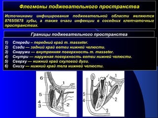 Флегмоны поджевательного пространстваФлегмоны поджевательного пространства
Границы поджевательного пространства
1) Спереди – передний край m. masseter.
2) Cзади — задний край ветви нижней челюсти.
3) Cнаружи — внутренняя поверхность m. masseter.
4) Cнутри — наружная поверхность ветви нижней челюсти.
5) Cверху — нижний край скуловой дуги.
6) Cнизу — нижний край тела нижней челюсти.
Источниками инфицирования поджевательной области являются
8765l5678 зубы, а также очаги инфекции в соседних клетчаточных
пространствах.
 