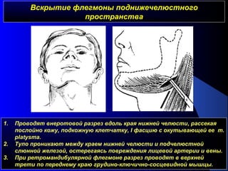 Вскрытие флегмоны поднижечелюстногоВскрытие флегмоны поднижечелюстного
пространствапространства
1. Проводят внеротовой разрез вдоль края нижней челюсти, рассекая
послойно кожу, подкожную клетчатку, I фасцию с окутывающей ее m.
platysma.
2. Тупо проникают между краем нижней челюсти и подчелюстной
слюнной железой, остерегаясь повреждения лицевой артерии и вены.
3. При ретромандибулярной флегмоне разрез проводят в верхней
трети по переднему краю грудино-ключично-сосцевидной мышцы.
 