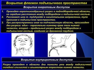 Вскрытие флегмон подъязычного пространстваВскрытие флегмон подъязычного пространства
1. Проводят воротникообразный разрез в подподбородочной области,
на середине расстояния между подбородком и подъязычной костью.
2. Рассекают шов m. mylohyoidei в сагиттальном направлении, тупо
проникая в подъязычное пространство.
3. При распространении гноя на подчелюстную область, производят
два разреза: один – параллельно нижнему краю тела нижней
челюсти, второй – продольный разрез между подбородком и
подъязычной костью, соединяя их дренажной трубкой.
Вскрытие внеротовым доступом
Вскрытие внутриротовым доступом
Разрез проводят в области дна полости рта между подъязычной
складкой слизистой и альвеолярным отростком нижней челюсти.
 
