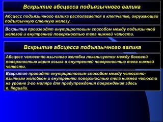 Вскрытие абсцесса подъязычного валикаВскрытие абсцесса подъязычного валика
Абсцесс подъязычного валика располагается в клетчатке, окружающей
подъязычную слюнную железу.
Вскрытие производят внутриротовым способом между подъязычной
железой и внутренней поверхностью тела нижней челюсти.
Вскрытие абсцесса подъязычного валикаВскрытие абсцесса подъязычного валика
Абсцесс челюстно-язычного желобка локализуется между боковой
поверхностью корня языка и внутренней поверхностью тела нижней
челюсти.
Вскрытие проводят внутриротовым способом между челюстно-
язычным желобком и внутренней поверхностью тела нижней челюсти
на уровне 2-го моляра для предупреждения повреждения здесь
n. lingualis.
 
