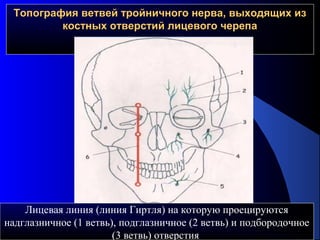 Топография ветвей тройничного нерва, выходящих изТопография ветвей тройничного нерва, выходящих из
костных отверстий лицевого черепакостных отверстий лицевого черепа
Лицевая линия (линия Гиртля) на которую проецируются
надглазничное (1 ветвь), подглазничное (2 ветвь) и подбородочное
(3 ветвь) отверстия
 