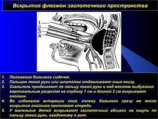 Вскрытие флегмон заглоточного пространстваВскрытие флегмон заглоточного пространства
1. Положение больного сидячее.
2. Пальцем левой руки или шпателем отдавливают язык книзу.
3. Скальпель продвигают по пальцу левой руки и над местом выбухания
вертикальным разрезом на глубину 1 см и длиной 2 см вскрывают
гнойник.
4. Во избежание аспирации гноя, голову больного сразу же после
вскрытия гнойника наклоняют кпереди.
5. У маленьких детей вскрывают заглоточный абсцесс на ощупь по
пальцу левой руки, введенному в рот.
 