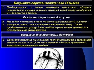 Вскрытие перитонзиллярного абсцессаВскрытие перитонзиллярного абсцесса
2. Проводят послойный разрез окаймляющий угол нижней челюсти.
3. Смещают задний полюс подчелюстной железы книзу и далее,
придерживаясь m. pterygoideus medialis тупым путем проникают в
окологлоточное пространство.
Вскрытие внеротовым доступом
Вскрытие внутриротовым доступом
1. Предварительно с целью уточнения локализации абсцесса
производится пункция гнойника толстой иглой между миндалиной
и небно-язычной дужкой.
2. Проводят мысленно линию между последним моляром и основанием
небного язычка, и на 0,5 см выше середины данного промежутка
скальпелем вскрывается гнойник.
 