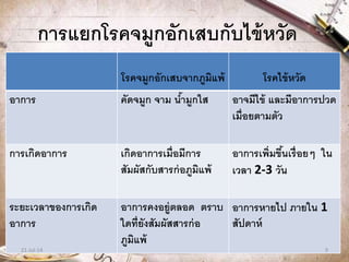 การแยกโรคจมูกอักเสบกับไข้หวัด
โรคจมูกอักเสบจากภูมิแพ้ โรคไข้หวัด
อาการ คัดจมูก จาม น้ามูกใส อาจมีไข้ และมีอาการปวด
เมื่อยตามตัว
การเกิดอาการ เกิดอาการเมื่อมีการ
สัมผัสกับสารก่อภูมิแพ้
อาการเพิ่มขึ้นเรื่อยๆ ใน
เวลา 2-3 วัน
ระยะเวลาของการเกิด
อาการ
อาการคงอยู่ตลอด ตราบ
ใดที่ยังสัมผัสสารก่อ
ภูมิแพ้
อาการหายไป ภายใน 1
สัปดาห์
21-Jul-14 9
 