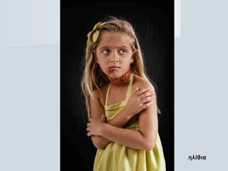 ηλίθιαηλίθια
 