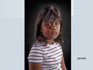 χοντρήχοντρή
 