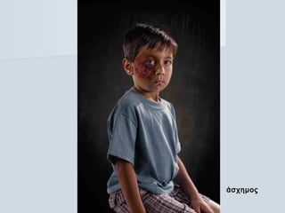 άσχημοςάσχημος
 