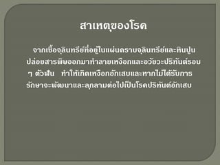 สาเหตุของโรค
จากเชื้อจุลินทรีย์ที่อยู่ในแผ่นคราบจุลินทรีย์และหินปูน
ปล่อยสารพิษออกมาทาลายเหงือกและอวัยวะปริทันต์รอบ
ๆ ตัวฟัน ทาให้เกิดเหงือกอักเสบและหากไม่ได้รับการ
รักษาจะพัฒนาและลุกลามต่อไปเป็ นโรคปริทันต์อักเสบ
 