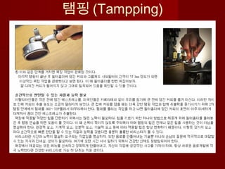 탬핑 (Tampping)
 