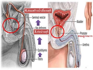 3.ท่อนาอสุจิ
4.ต่อมสร้างน้าเลี้ยงอสุจิ
ต่อมลูกหมาก
 