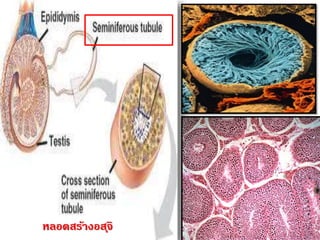 หลอดสร้างอสุจิ
 