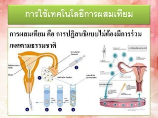 การใช้เทคโนโลยีการผสมเทียม
กำรผสมเทียม คือ กำรปฏิสนธิแบบไม่ต้องมีกำรร่วม
เพศตำมธรรมชำติ
 