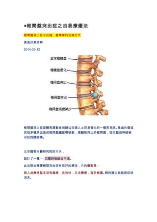 ●椎間盤突出症之自我療癒法 
椎間盤突出症不花錢、最簡單的治療方式 
真是好東西啊 
2014-03-12 
椎間盤突出症是體育運動者和辦公白領人士容易發生的一種常見病。是由外傷或 
其他多種原因造成椎間盤纖維環破裂，使髓核突出於椎間盤，從而壓迫神經根 
引起的腰腿痛。 
北京國都尚醫研究院的大夫， 
設計了一種 --- 沉腰斜板組合手法。 
此法對治療腰椎間突出症有很好的療效，它的優點是： 
病人治療時基本沒有痛感，見效快，方法簡便，宜於推廣。輕的幾次就能使症狀 
消失。 
 