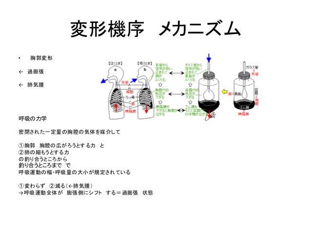 2 4肺の過膨張の機序樽状変形