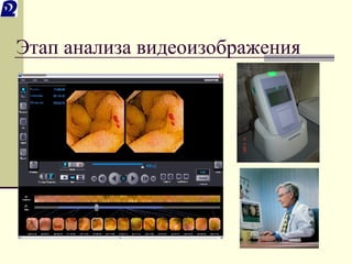Этап анализа видеоизображения 
 