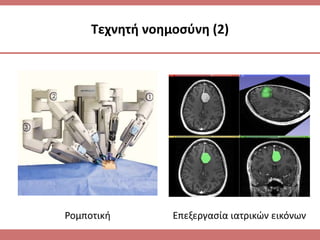 Τεχνητή νοημοσύνη (2) 
Ρομποτική Επεξεργασία ιατρικών εικόνων 
 