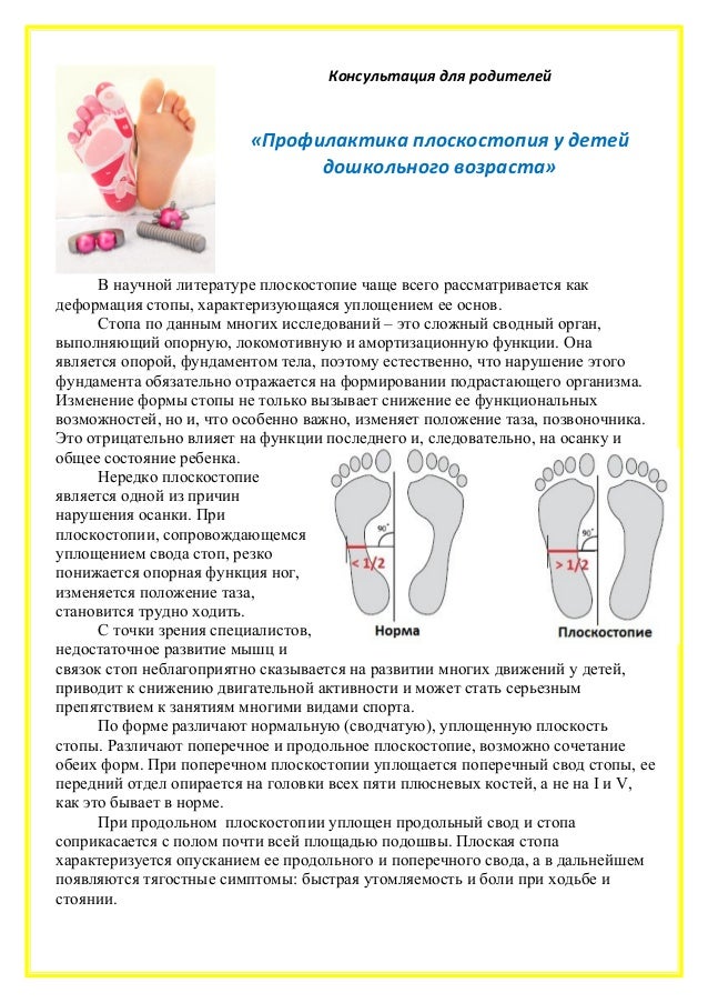 Профилактика плоскостопия у малышей