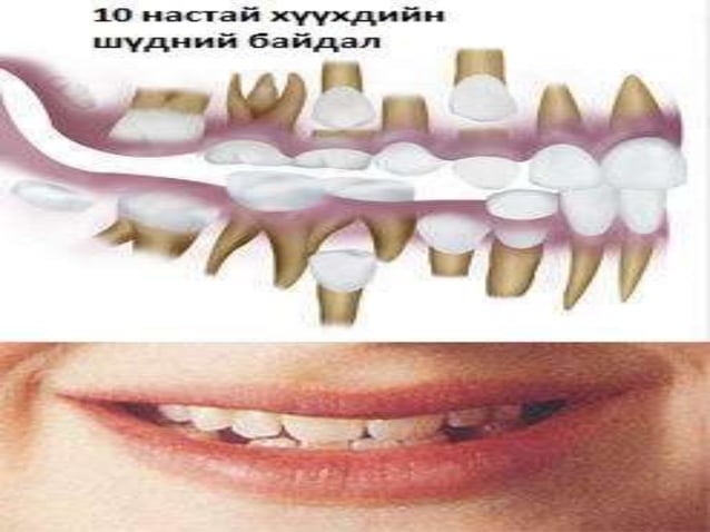 сүүн шүд болон байнгын шүдний онцлог
