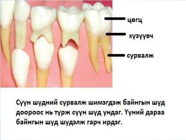 сүүн шүд болон байнгын шүдний онцлог