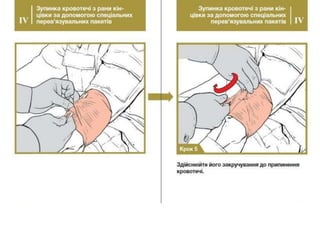 долікарська допомога