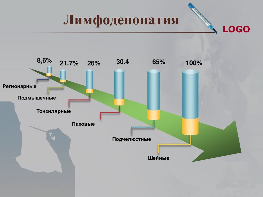 инфекционный мононуклеоз