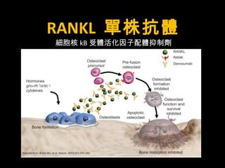 RANKL 單株抗體 
細胞核kB受體活化因子配體抑制劑 
Prolia 保骼麗 denosumab 
 