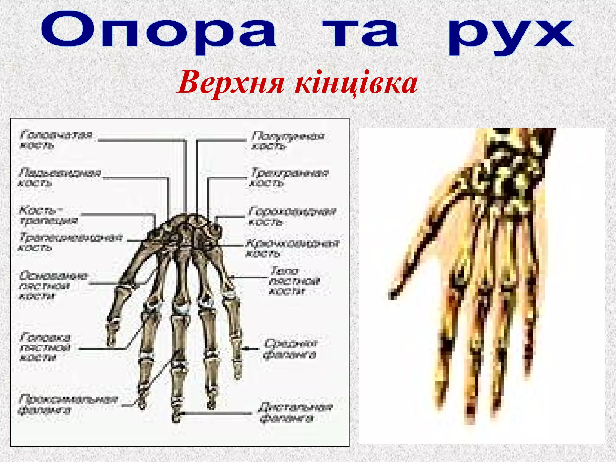 Верхня кінцівка 
 