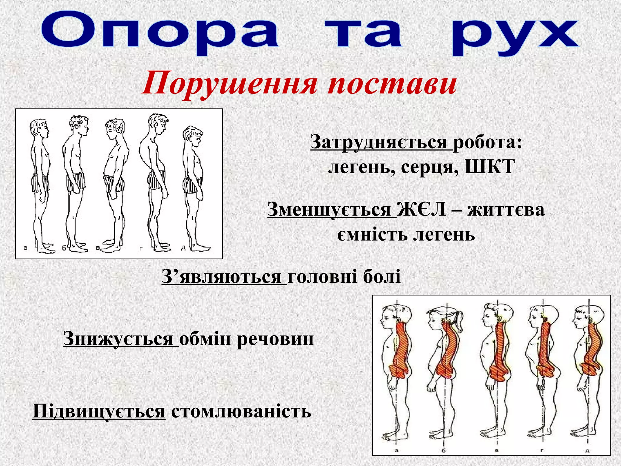 Порушення постави 
Затрудняється робота: 
легень, серця, ШКТ 
Зменшується ЖЄЛ – життєва 
З’являються головні болі 
Знижується обмін речовин 
Підвищується стомлюваність 
ємність легень 
 